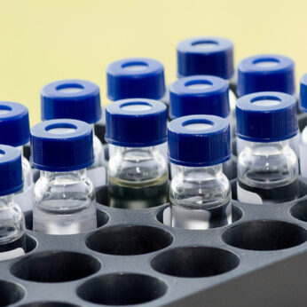 A rectangular laboratory tray organized with multiple clear glass sample vials featuring blue caps