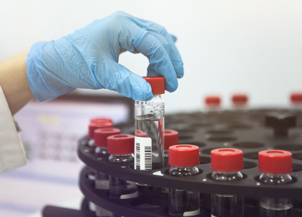 A gloved hand placing a clear glass sample vial with a barcode and red cap into a circular autosampler tray
